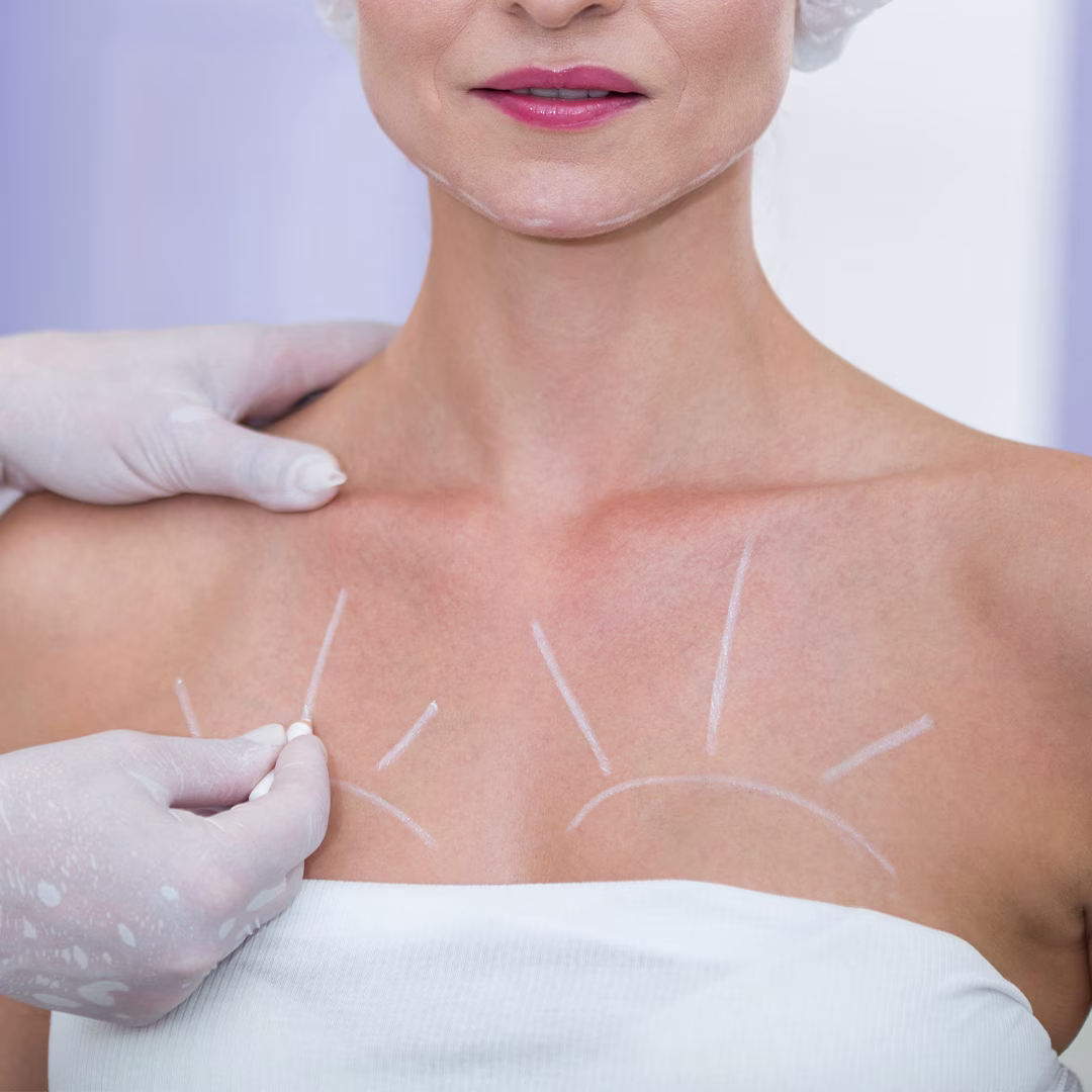 Revision breast surgery for previously operated breasts