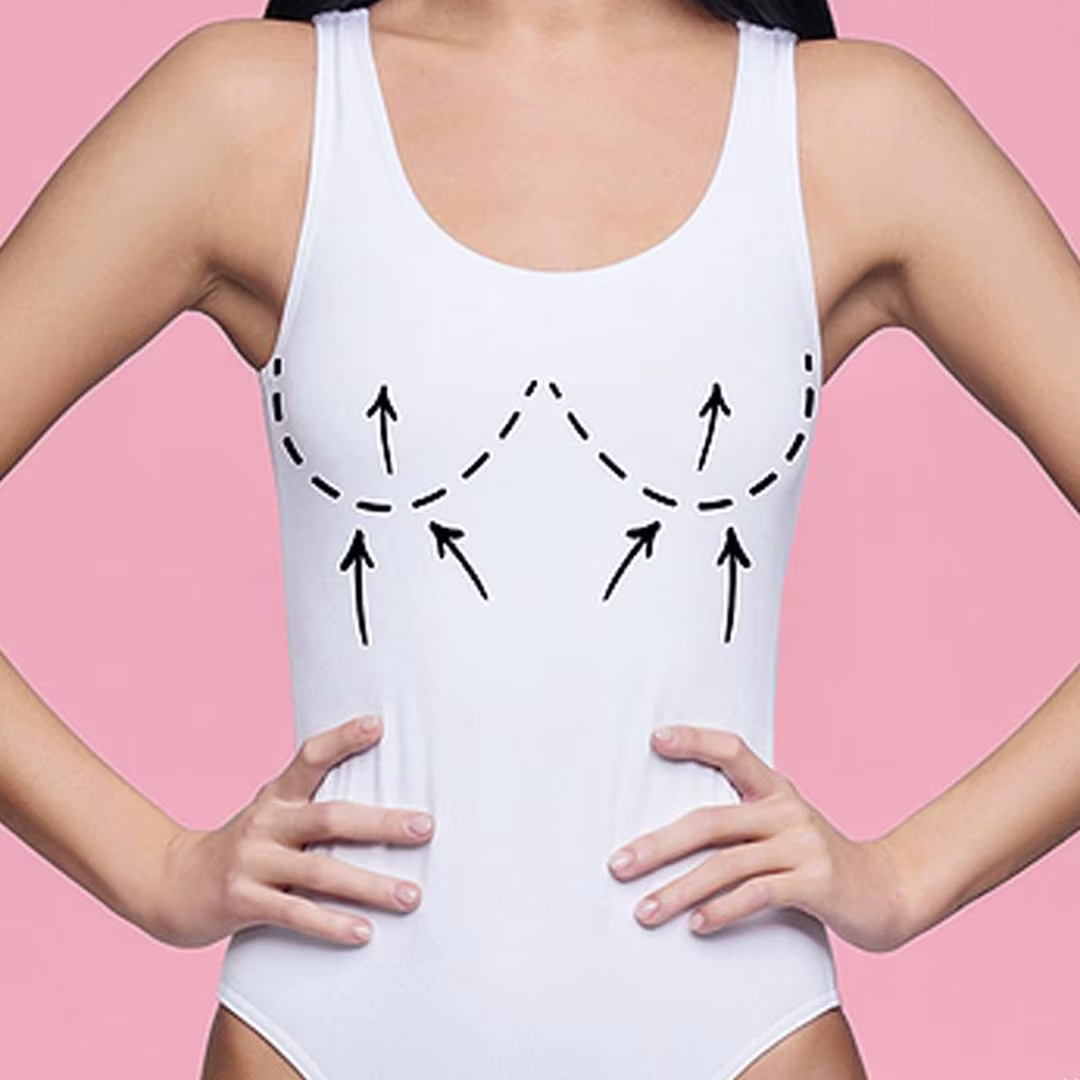 Breast lift (mastopexy) with skilled surgeons in Istanbul